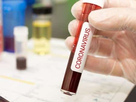 Estado do Rio tem 13 casos notificados em investigação de novas variantes do Coronavírus