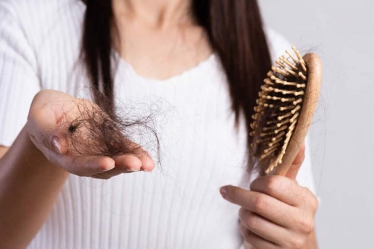 Fernanda Dias – Queda de cabelo:  entenda quais são as principais causas desse desequilíbrio e as melhores formas de tratamento