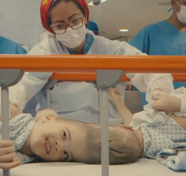 Cirurgia de separação de gêmeos que nasceram presos pela cabeça foi feita no Centro do Rio; procedimento foi bem sucedido